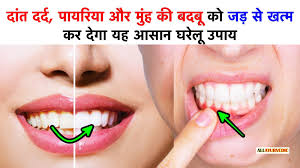 दाँतो के सभी रोगों का घरेलू उपाय