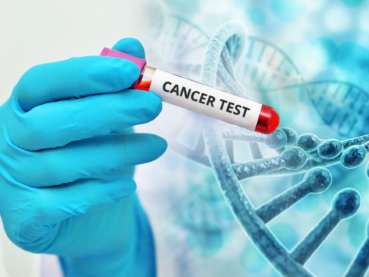 कब कराएं कैंसर टेस्ट